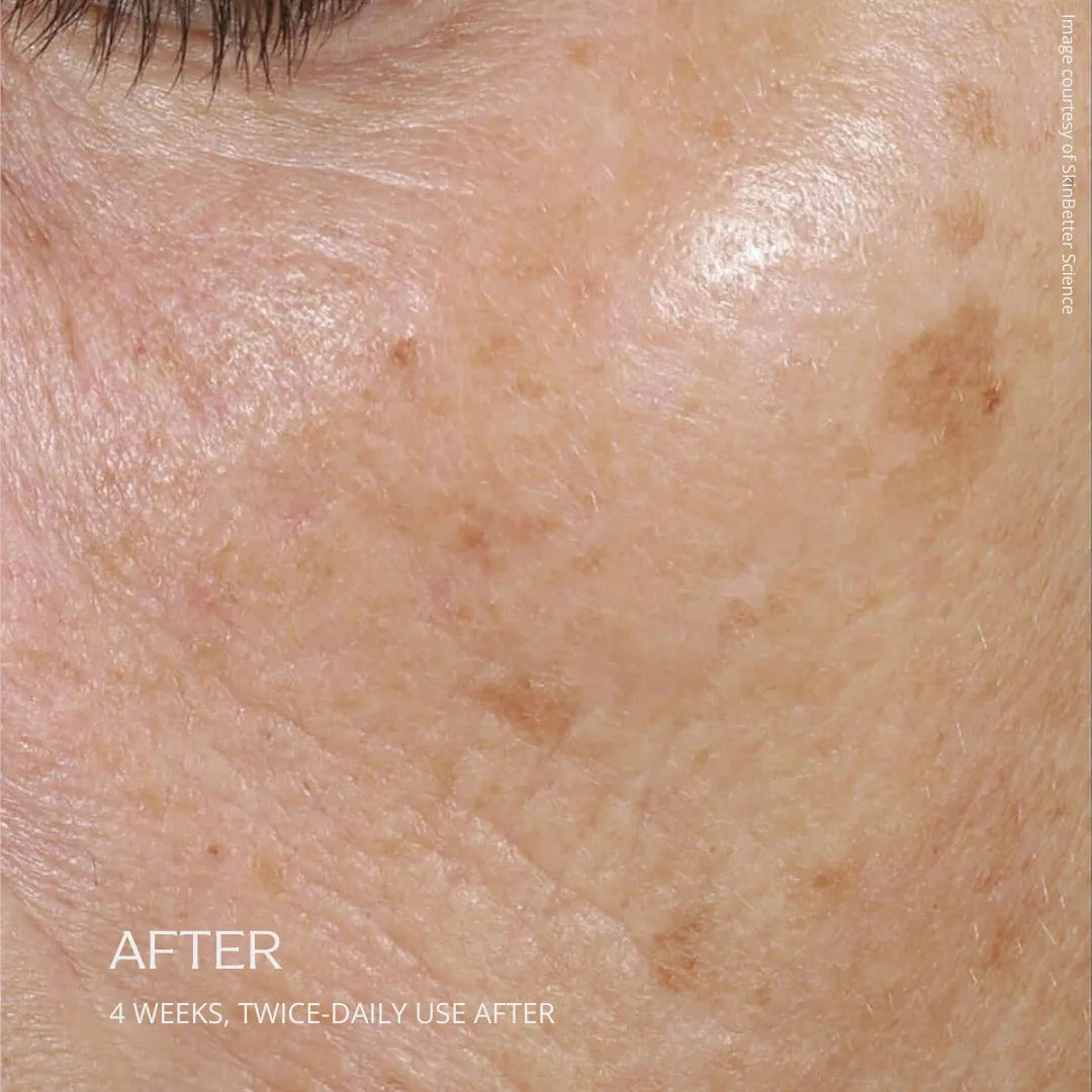 Hydrating Trio - <b>Rebalancing Moisture Treatment</b>