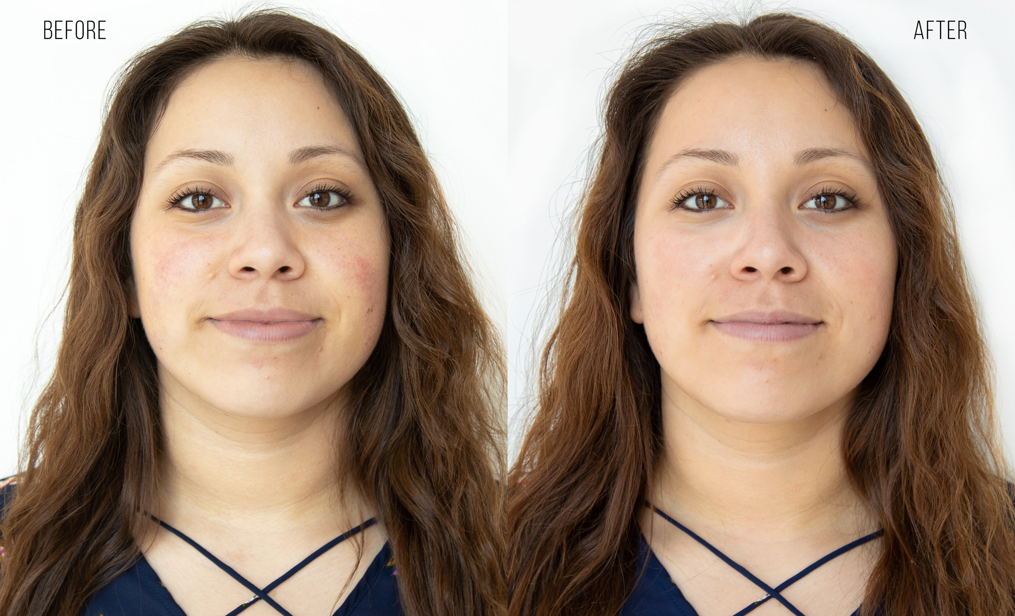 Pre-Event Glow-Up - HydraFacial +Dermaplane +LED Mask