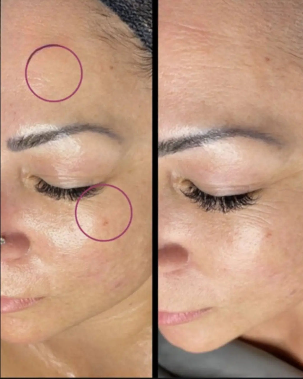 Glo2Facial - <b>Radiance Boost Treatment</b>