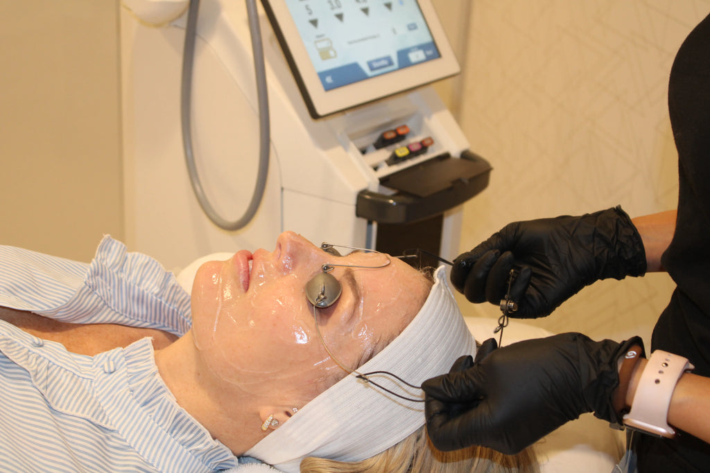 BBL Laser for Face - <b>New Client Special</b>