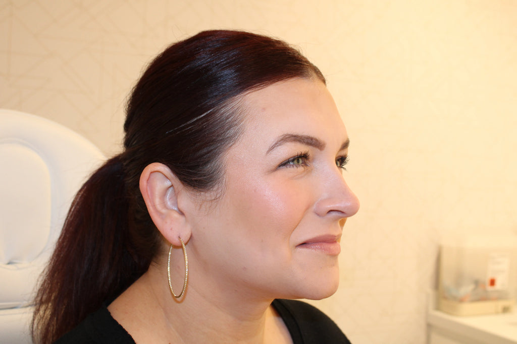 Forehead Tox - <b>New Client Special</b>