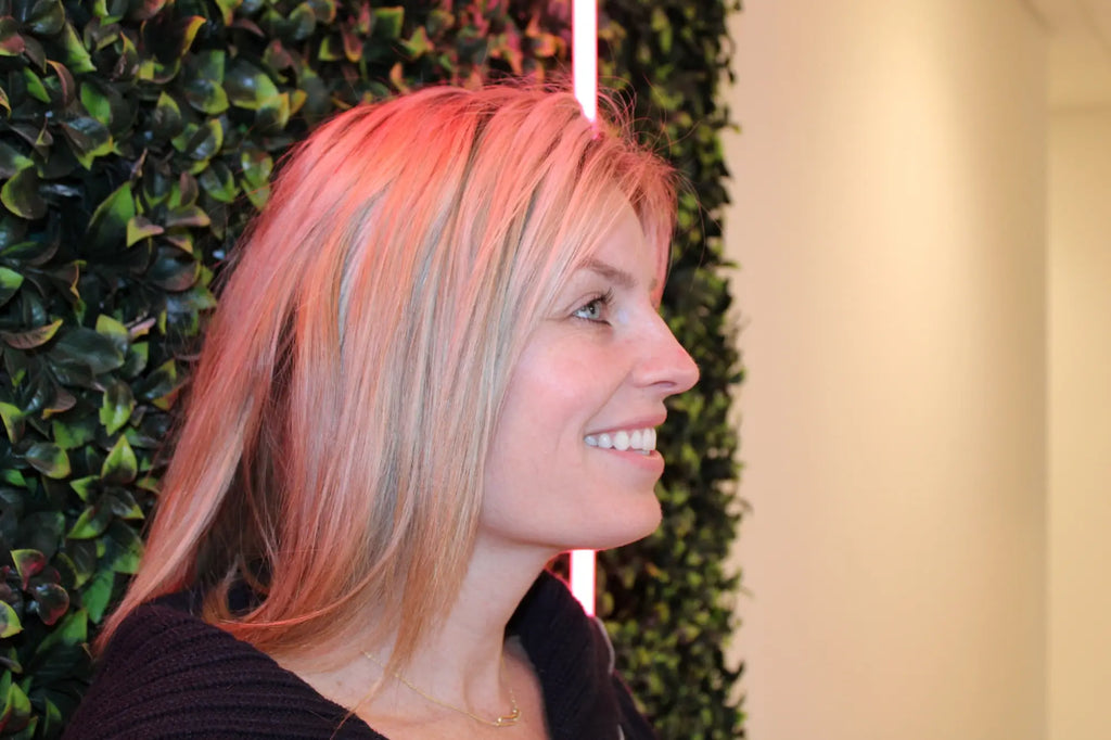 BBL Laser for Face - <b>New Client Special</b>