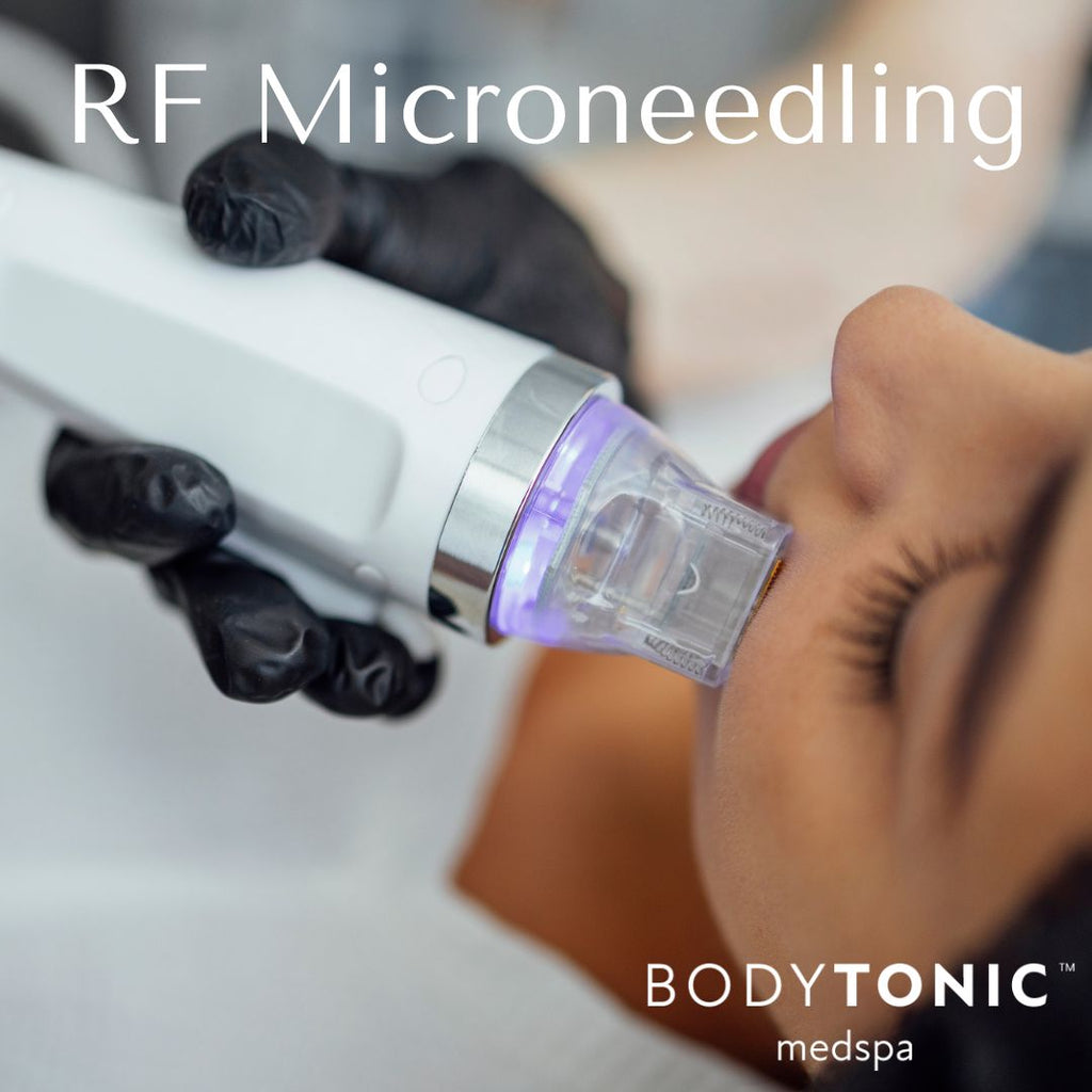 Virtue RF Microneedling (Face & Neck)