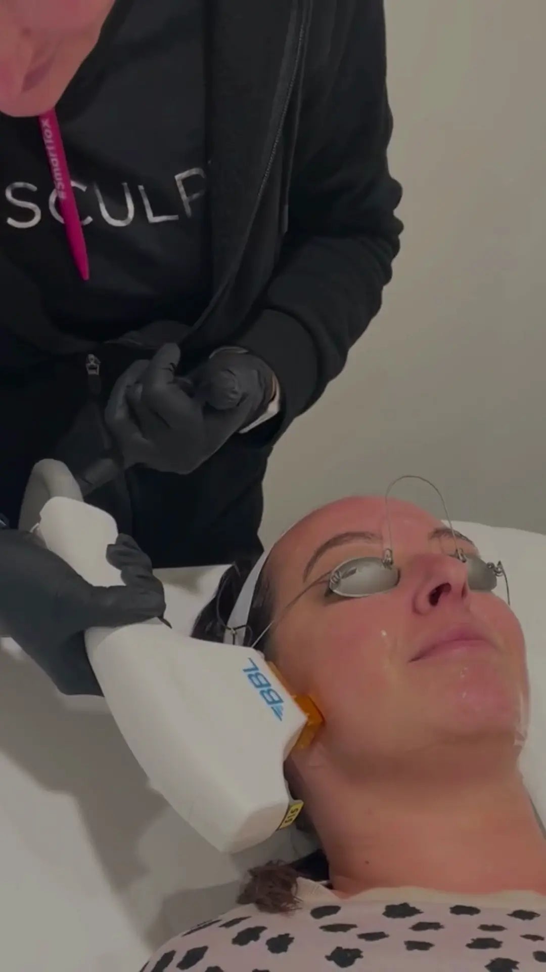 BBL Laser for Face - <b>New Client Special</b>