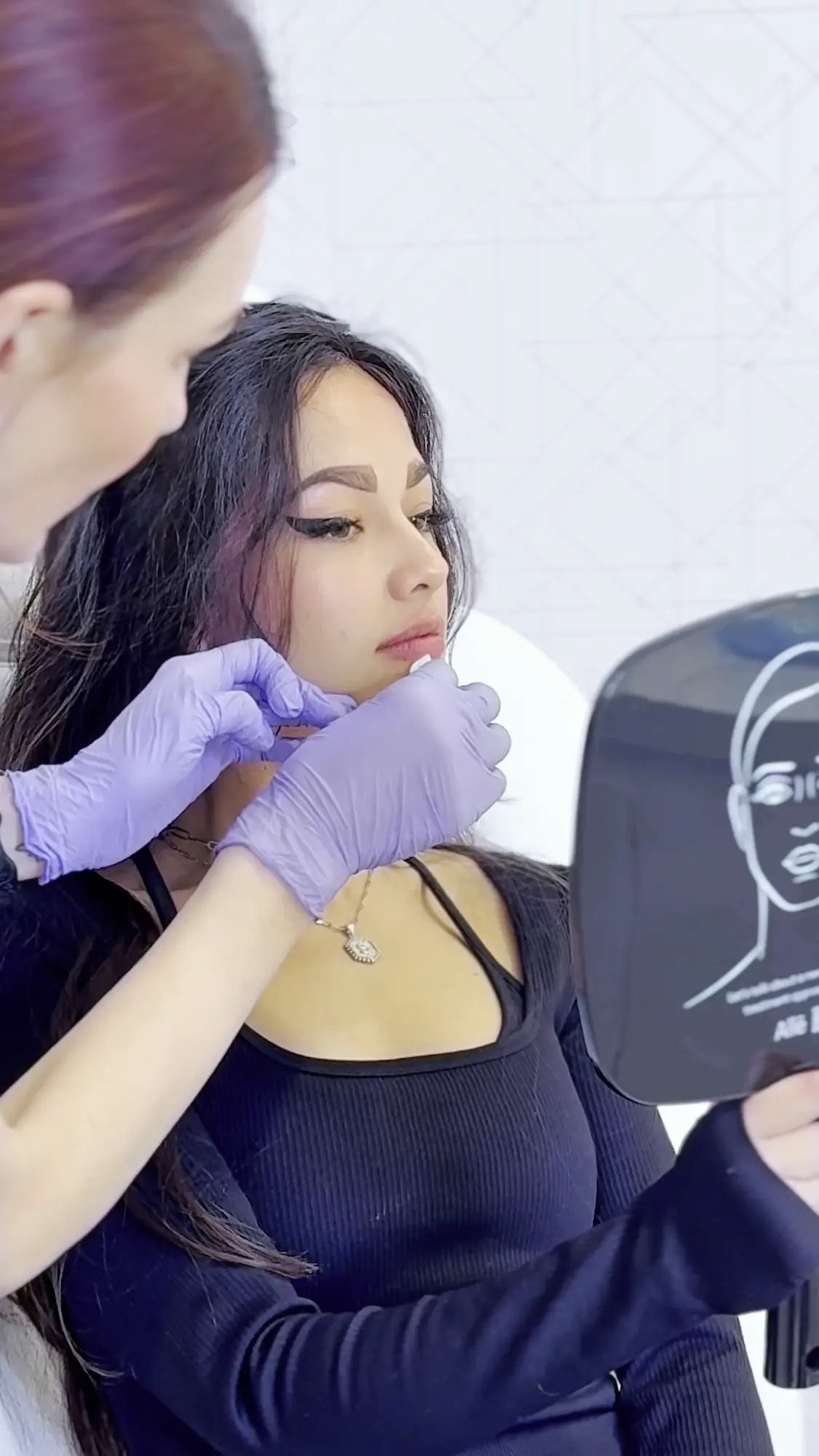 Lip Filler